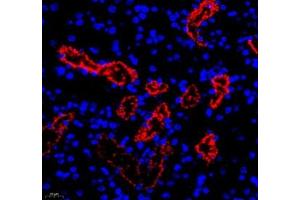 Immunofluorescence of paraffin embedded mouse kidney using RBP (ABIN7075409) at dilution of 1: 650 (400x lens)