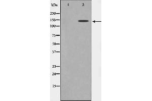 Western blot analysis on Jurkat cell lysate using MAST3 Antibody,The lane on the left is treated with the antigen-specific peptide. (MAST3 anticorps  (Internal Region))