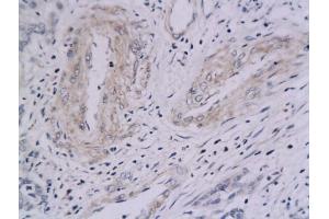 anti-Integrin alpha V, Integrin beta 5 (ITGAV/ITGB5) antibody