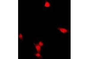 Immunofluorescent analysis of ZNF397 staining in HepG2 cells.