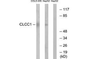 Western blot analysis of extracts from COLO/HepG2 cells, using CLCC1 Antibody. (CLCC1 anticorps  (AA 391-440))