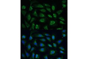 Immunofluorescence analysis of U-2 OS cells using SPARC Polyclonal Antibody (ABIN7270183) at dilution of 1:100 (40x lens).