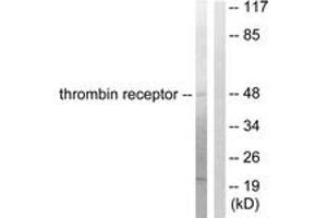 Western blot analysis of extracts from HeLa cells, treated with Nocodazole 1ug/ml 18h, using Thrombin Receptor Antibody. (PAR1 anticorps  (AA 10-59))