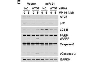 Effect of autophagy on miR-21-induced drug resistance.