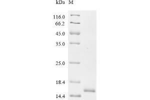 (Tris-Glycine gel) Discontinuous SDS-PAGE (reduced) with 5 % enrichment gel and 15 % separation gel.