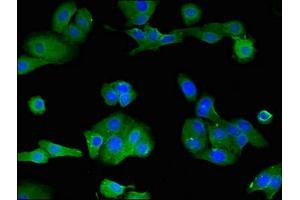 anti-Lipoxygenase Homology Domains 1 (LOXHD1) (AA 1101-1366) antibody