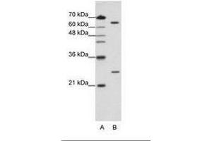 Image no. 2 for anti-Nudix (Nucleoside Diphosphate Linked Moiety X)-Type Motif 21 (NUDT21) (N-Term) antibody (ABIN202092) (NUDT21 anticorps  (N-Term))