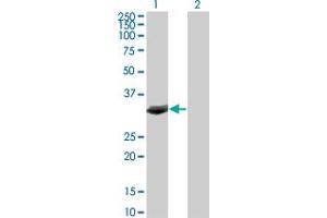 Western Blot analysis of FBXO6 expression in transfected 293T cell line by FBXO6 monoclonal antibody (M01), clone 3F10.