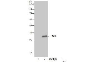 IP Image Immunoprecipitation of DCK protein from 293T whole cell extracts using 5 μg of DCK antibody, Western blot analysis was performed using DCK antibody, EasyBlot anti-Rabbit IgG  was used as a secondary reagent.