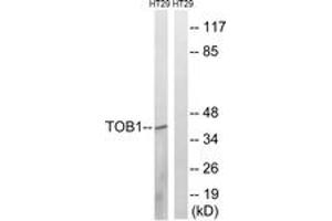 Western blot analysis of extracts from HT-29 cells, treated with serum 20% 15', using TOB1 (Ab-164) Antibody. (Protein Tob1 (TOB1) (AA 130-179) anticorps)