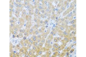 Immunohistochemistry of paraffin-embedded Human liver using IL20 Polyclonal Antibody at dilution of 1:100 (40x lens). (IL-20 anticorps)