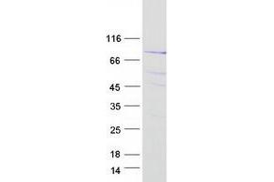 Validation with Western Blot