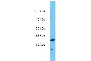 Western Blotting (WB) image for anti-HD Domain Containing 2 (HDDC2) (N-Term) antibody (ABIN2787774) (HDDC2 anticorps  (N-Term))
