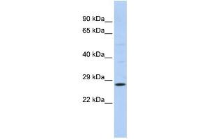 Western Blotting (WB) image for anti-RAB38, Member RAS Oncogene Family (RAB38) antibody (ABIN2458672) (RAB38 anticorps)
