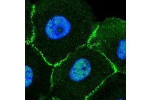 Immunofluorescent staining of human cell line A-431 with MLLT4 polyclonal antibody  at 1-4 ug/mL dilution shows positivity in nucleus but not nucleoli, plasma membrane and cell junctions. (Afadin anticorps)