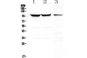 Western blot analysis of Dynamin 1 using anti-Dynamin 1 antibody . (Dynamin 1 anticorps  (AA 616-667))