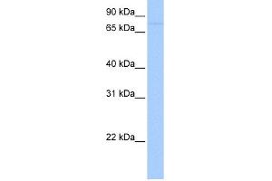 WB Suggested Anti-SAMD4A Antibody Titration: 0.