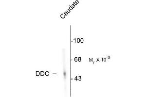 Image no. 1 for anti-Dopa Decarboxylase (Aromatic L-Amino Acid Decarboxylase) (DDC) antibody (ABIN372608) (DDC anticorps)