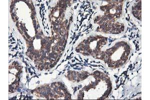 Immunohistochemical staining of paraffin-embedded Human breast tissue using anti-HMOX2 mouse monoclonal antibody. (HMOX2 anticorps)