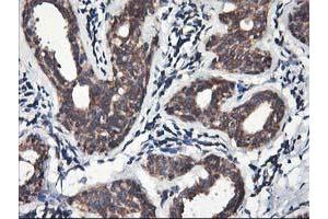 Immunohistochemical staining of paraffin-embedded Human breast tissue using anti-HMOX2 mouse monoclonal antibody. (HMOX2 anticorps)