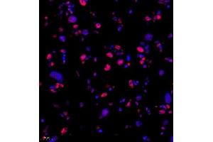 Immunofluorescence of paraffin embedded rat placenta using Skar (ABIN7074970) at dilution of 1:950 (400x lens) (p46 anticorps)