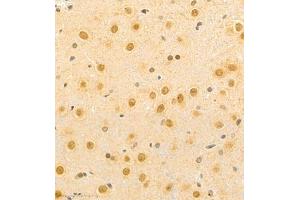 Immunohistochemistry of paraffin embedded rat brain using BPTF (ABIN7073234) at dilution of 1:500 (400x lens)