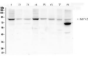 Western blot analysis of Mitofusin 2 using anti- Mitofusin 2 antibody .