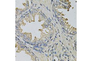 Immunohistochemistry of paraffin-embedded human prostate using LITAF Antibody (ABIN1876657) at dilution of 1:100 (40x lens). (LITAF anticorps)