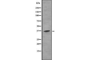Western blot analysis of Cathepsin H using K562 whole cell lysates (Cathepsin H anticorps  (Internal Region))
