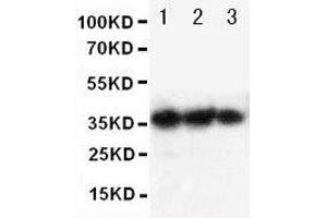 Anti-human EPO antibody, Western blotting Lane 1: Recombinant human EPO Protein 10ng Lane 2: Recombinant human EPO Protein 5ng Lane 3: Recombinant human EPO Protein 2 (EPO anticorps  (AA 1-166))