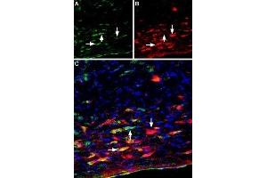 Multiplex staining of Plexin-A2 and p75NTR in rat brain - Immunohistochemical staining of perfusion-fixed frozen rat brain sections using Anti-Plexin-A2 (extracellular) Antibody (ABIN7043437, ABIN7045130 and ABIN7045131), (1:400) and Mouse Anti-Rat p75 NGF Receptor (extracellular) Antibody (#AN-170), (1:300). (NGFR anticorps  (Soluble))