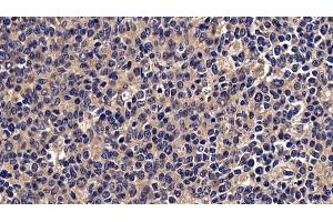 Detection of MIP3b in Human amygdalitis Tissue using Polyclonal Antibody to Macrophage Inflammatory Protein 3 Beta (MIP3b)