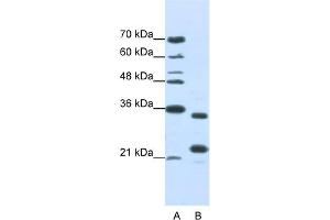 WB Suggested Anti-ALKBH8 Antibody Titration:  1. (ALKBH8 anticorps  (N-Term))