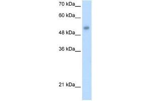 Human HepG2; WB Suggested Anti-ONECUT3 Antibody Titration: 1. (ONECUT3 anticorps  (C-Term))
