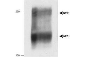 Western blot analysis of NPC1 in 20 ug of human fibroblast cell lysate with NPC1 polyclonal antibody .