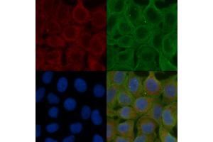 ABIN6257898 and ABIN6275911 staining Hela cells(24h of starvation treatment) by IF/ICC. (Serotonin Receptor 5A anticorps  (Internal Region))