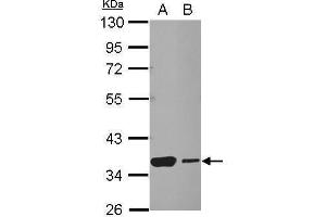 WB Image Sample (30 ug of whole cell lysate) A: NT2D1 B: SK-N-SH 10% SDS PAGE antibody diluted at 1:1000