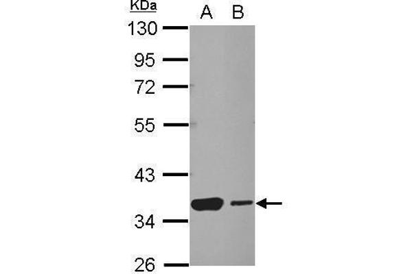 HSF2BP anticorps