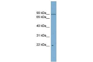 WB Suggested Anti-C12orf11  Antibody Titration: 0.