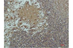 Immunohistochemical (IHC) analysis of paraffin-embedded Human Brain Tissue using a-tubulin(Acetyl Lys40) Mouse Monoclonal Antibody diluted at 1:200. (alpha Tubulin anticorps  (acLys40))