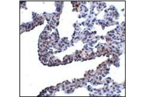 Immunohistochemistry of PCDH12 in rat lung tissue with this product at 5 μg/ml. (PCDH12 anticorps  (N-Term))