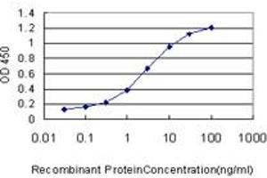 anti-CaM Kinase-Like Vesicle-Associated (CAMKV) (AA 1-501) antibody
