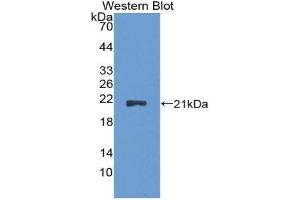 Detection of Recombinant CDKN2A, Rat using Polyclonal Antibody to Cyclin Dependent Kinase Inhibitor 2A (CDKN2A) (CDKN2A anticorps  (AA 3-155))