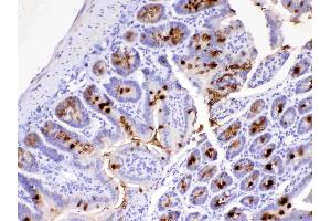 IHC analysis of MUC2 using anti-MUC2 antibody . (MUC2 anticorps)