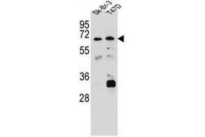 CES4A anticorps  (C-Term)