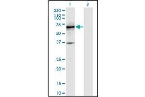 Western Blotting (WB) image for anti-Protein Tyrosine Phosphatase, Receptor Type, N (PTPRN) antibody (ABIN954381)
