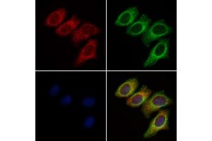 ABIN6261371 and ABIN6277296 staining Hela cells by IF/ICC. (Dynamin 1-Like anticorps  (C-Term))