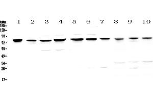 Western blot analysis of PARN using anti-PARN antibody . (PARN anticorps  (AA 1-301))