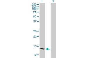 anti-Peripheral-Type Benzodiazepine Receptor (TSPO) (AA 1-169) antibody