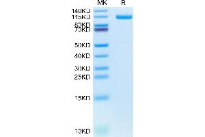 Biotinylated Human CDH17 on Tris-Bis PAGE under reduced condition. (LI Cadherin Protein (AA 23-787) (His-Avi Tag,Biotin))